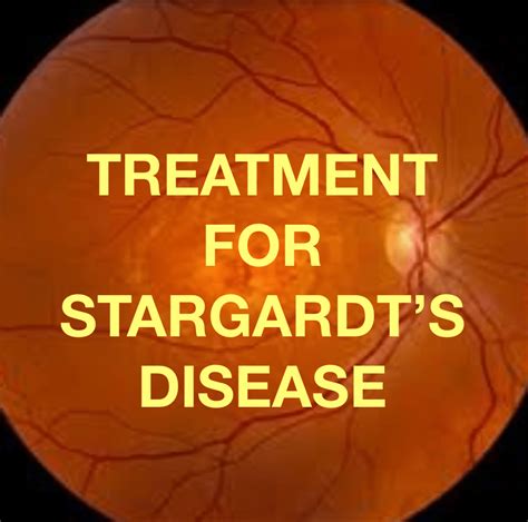Discover Hope and Relief: Treatment Options for Stargardt Disease From Your Local Optometrist